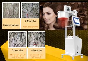 Cheap 650nm Laser Hair Growth Machine Scalp Treatment Regrowth Salon Equipment wholesale
